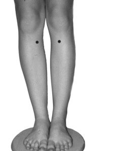 Иллюстрация к книге — Целительные точки для лечения щитовидной железы [autogen_ebook_id14.jpg]