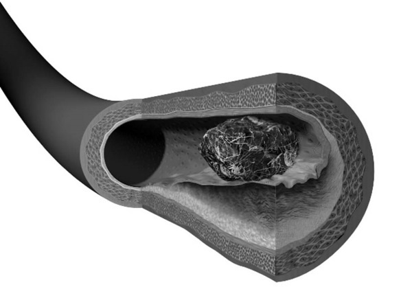 Иллюстрация к книге — Лучшие методы лечения и профилактики инфаркта миокарда [i_011.jpg]