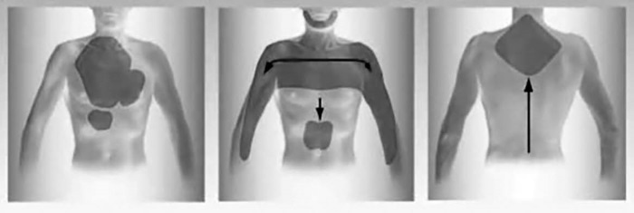 Иллюстрация к книге — Лучшие методы лечения и профилактики инфаркта миокарда [i_012.jpg]