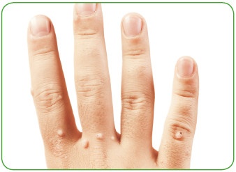 Иллюстрация к книге — Энциклопедия диагностики и лечения от А до Я [i_046.jpg]