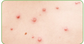 Иллюстрация к книге — Энциклопедия диагностики и лечения от А до Я [i_055.jpg]