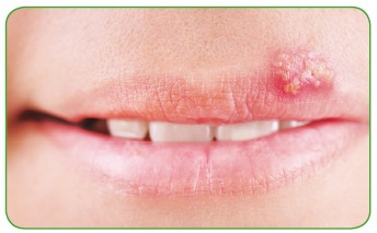 Иллюстрация к книге — Энциклопедия диагностики и лечения от А до Я [i_074.jpg]