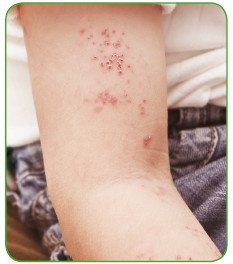 Иллюстрация к книге — Энциклопедия диагностики и лечения от А до Я [i_075.jpg]