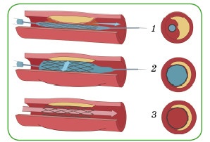 Иллюстрация к книге — Энциклопедия диагностики и лечения от А до Я [i_118.jpg]