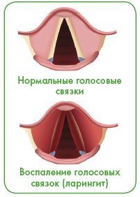 Иллюстрация к книге — Энциклопедия диагностики и лечения от А до Я [i_127.jpg]