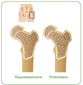 Иллюстрация к книге — Энциклопедия диагностики и лечения от А до Я [i_149.jpg]