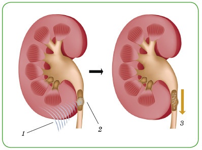 Иллюстрация к книге — Энциклопедия диагностики и лечения от А до Я [i_171.jpg]