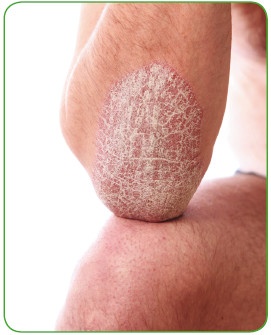 Иллюстрация к книге — Энциклопедия диагностики и лечения от А до Я [i_172.jpg]