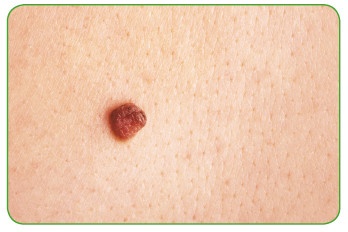 Иллюстрация к книге — Энциклопедия диагностики и лечения от А до Я [i_177.jpg]