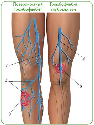 Иллюстрация к книге — Энциклопедия диагностики и лечения от А до Я [i_203.jpg]