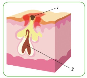 Иллюстрация к книге — Энциклопедия диагностики и лечения от А до Я [i_205.jpg]