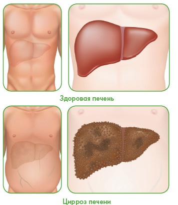 Иллюстрация к книге — Энциклопедия диагностики и лечения от А до Я [i_212.jpg]
