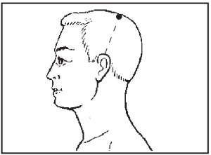 Иллюстрация к книге — Болезни от А до Я. Традиционное и нетрадиционное лечение [i_032.jpg]