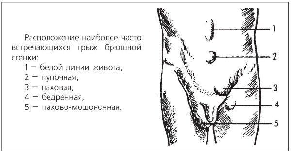 Иллюстрация к книге — Болезни от А до Я. Традиционное и нетрадиционное лечение [i_041.jpg]