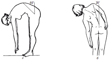 Иллюстрация к книге — Как избавиться от боли в спине [i_012.jpg]