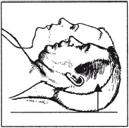 Иллюстрация к книге — Как избавиться от боли в спине [i_062.jpg]