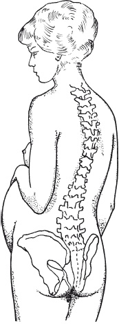 Иллюстрация к книге — Как избавиться от боли в спине [i_091.jpg]