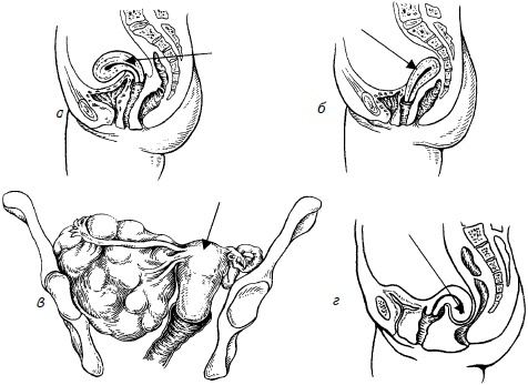 Иллюстрация к книге — Гимнастика для женщин [i_010.jpg]