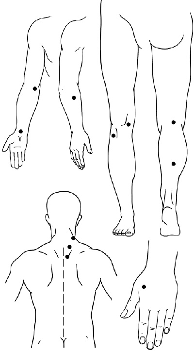 Иллюстрация к книге — Работа с триггерными точками: расслабляем мышцы, избавляемся от боли [_04.jpg]