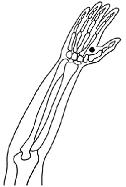 Иллюстрация к книге — Работа с триггерными точками: расслабляем мышцы, избавляемся от боли [_05.jpg]