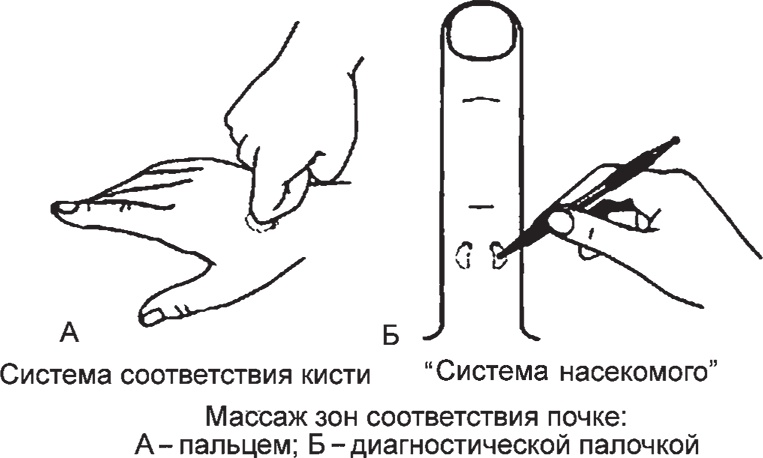 Иллюстрация к книге — Суджок - исцеляющий самомассаж. Основные приемы [autogen_ebook_id46.jpg]