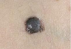 Иллюстрация к книге — Опасные родинки [autogen_ebook_id124.jpg]