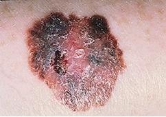 Иллюстрация к книге — Опасные родинки [autogen_ebook_id125.jpg]