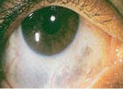 Иллюстрация к книге — Опасные родинки [autogen_ebook_id129.jpg]