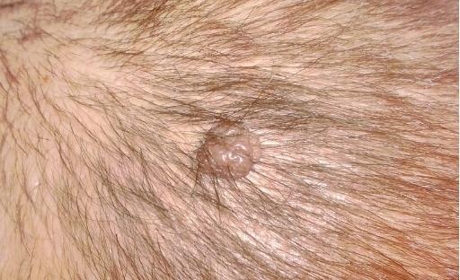 Иллюстрация к книге — Опасные родинки [autogen_ebook_id133.jpg]