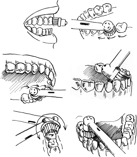 Иллюстрация к книге — 36 и 6 правил здоровых зубов [_11.jpg]