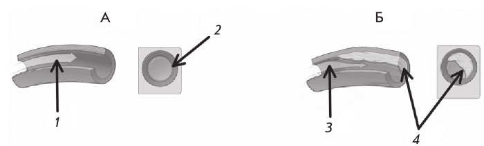 Иллюстрация к книге — Стенокардия [i_006.jpg]