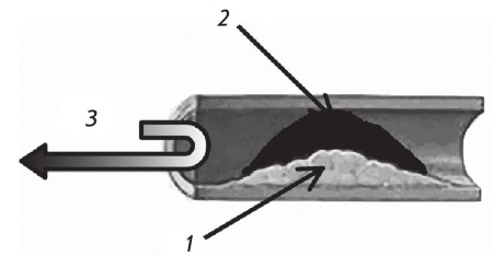 Иллюстрация к книге — Стенокардия [i_009.jpg]