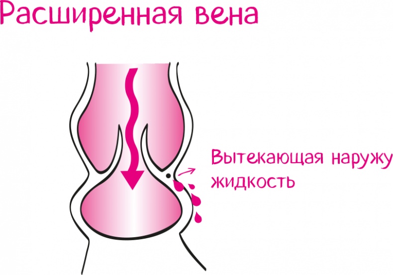 Иллюстрация к книге — Целлюлит. Циничный оберег от главного врага женщин [i_046.jpg]