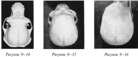 Иллюстрация к книге — Эректус бродит между нами. Покорение белой расы [p914_p915_p916.jpg]