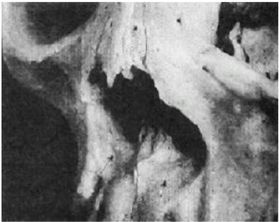 Иллюстрация к книге — Эректус бродит между нами. Покорение белой расы [p923.jpg]