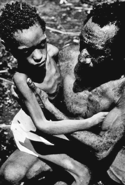 Иллюстрация к книге — Дуэль нейрохирургов. Как открывали тайны мозга, и почему смерть одного короля смогла перевернуть науку [i_023.jpg]