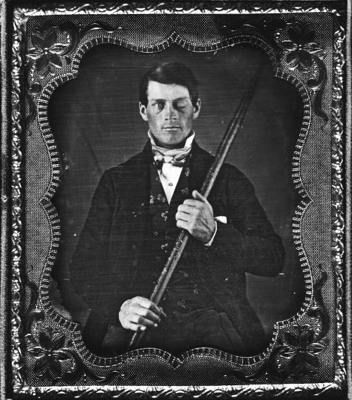 Иллюстрация к книге — Дуэль нейрохирургов. Как открывали тайны мозга, и почему смерть одного короля смогла перевернуть науку [i_045.jpg]