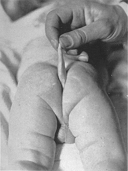 Иллюстрация к книге — Синдром Паганини и другие правдивые истории о гениальности, записанные в нашем генетическом коде [i_011.jpg]