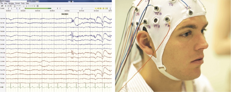 Иллюстрация к книге — Мозг. Ваша личная история [i_040.jpg]