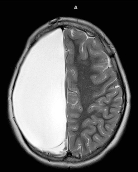 Иллюстрация к книге — Мозг. Ваша личная история [i_084.jpg]