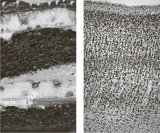 Иллюстрация к книге — Коннектом. Как мозг делает нас тем, что мы есть [i_040.jpg]