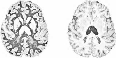 Иллюстрация к книге — Мы - это наш мозг. От матки до Альцгеймера [i_026.jpg]