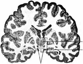 Иллюстрация к книге — Мы - это наш мозг. От матки до Альцгеймера [i_029.jpg]