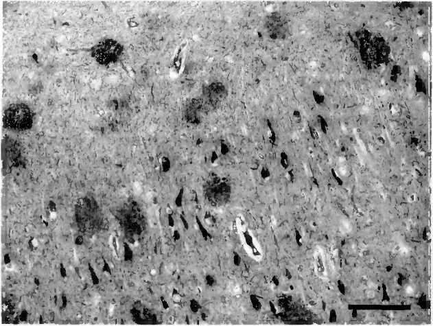 Иллюстрация к книге — Мы - это наш мозг. От матки до Альцгеймера [i_040.jpg]