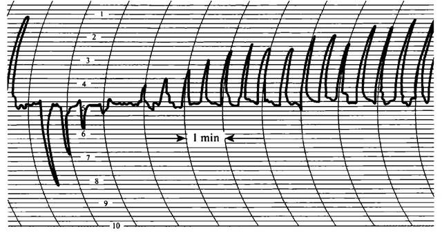 Иллюстрация к книге — История лазера [i_043.jpg]