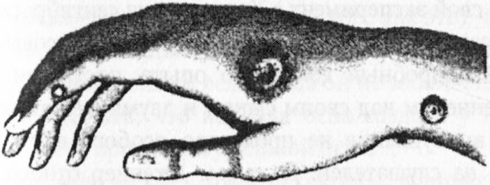 Иллюстрация к книге — Десять величайших открытий в истории медицины [i_011.jpg]