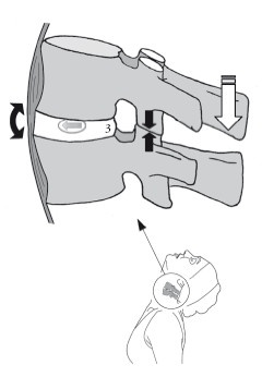 Иллюстрация к книге — Диагностика и лечение позвоночника. Уникальная система доктора А. М. Уриа [i_039.jpg]