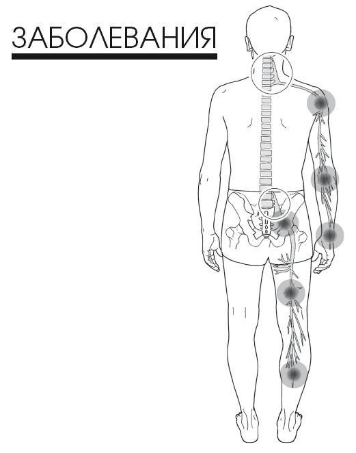 Иллюстрация к книге — Диагностика и лечение позвоночника. Уникальная система доктора А. М. Уриа [i_234.jpg]