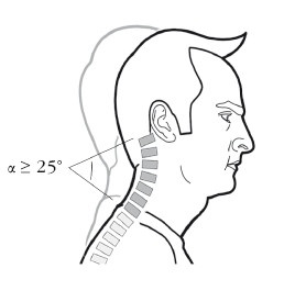Иллюстрация к книге — Диагностика и лечение позвоночника. Уникальная система доктора А. М. Уриа [i_254.jpg]