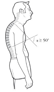 Иллюстрация к книге — Диагностика и лечение позвоночника. Уникальная система доктора А. М. Уриа [i_258.jpg]